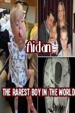 Watch Aidan The Rarest Boy In The World M4ufree