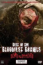 Watch TNA Wrestling: Best of the Bloodiest Brawls - Scars and Stitches M4ufree