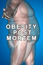 Watch Obesity: The Post Mortem Online M4ufree