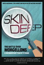 Watch Skin Deep: The Battle Over Morgellons M4ufree