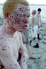 Watch Albino United M4ufree