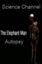 Watch Science Channel Elephant Man Autopsy M4ufree