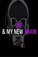 Watch Me & My New Brain M4ufree