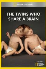 Watch National Geographic The Twins Who Share A Brain M4ufree