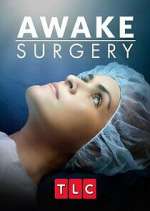 Watch Awake Surgery M4ufree